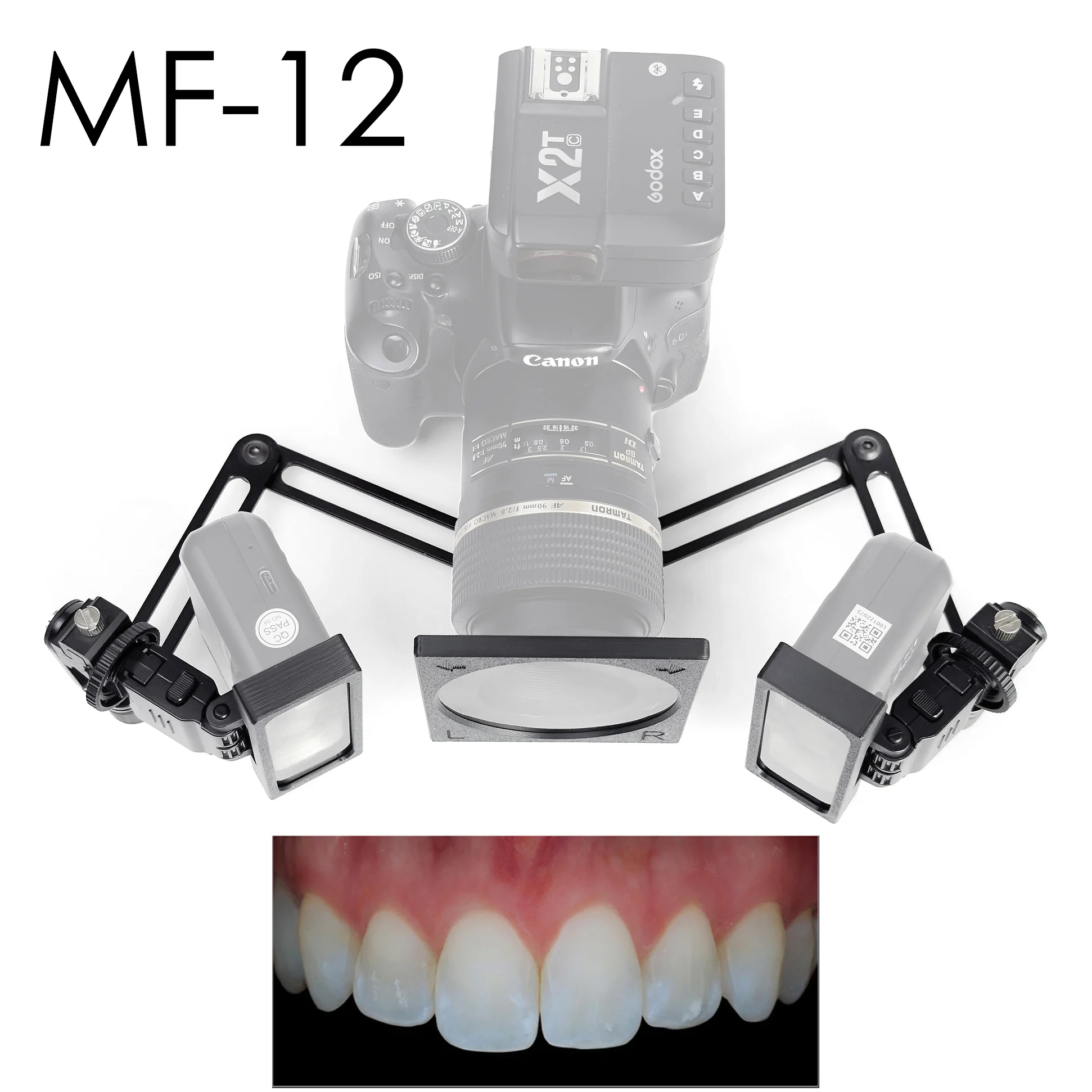Photography Lighting Kit Godox - Godox MF12 カメラ用フラッシュフィルターセット 偏光子キット クロス偏光歯科写真撮影キット 歯科医師向け反射なしキット